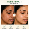 Pigmentation Cream