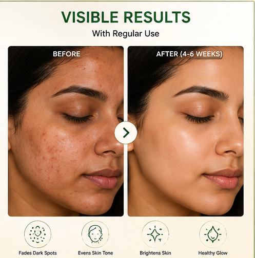 Pigmentation Cream