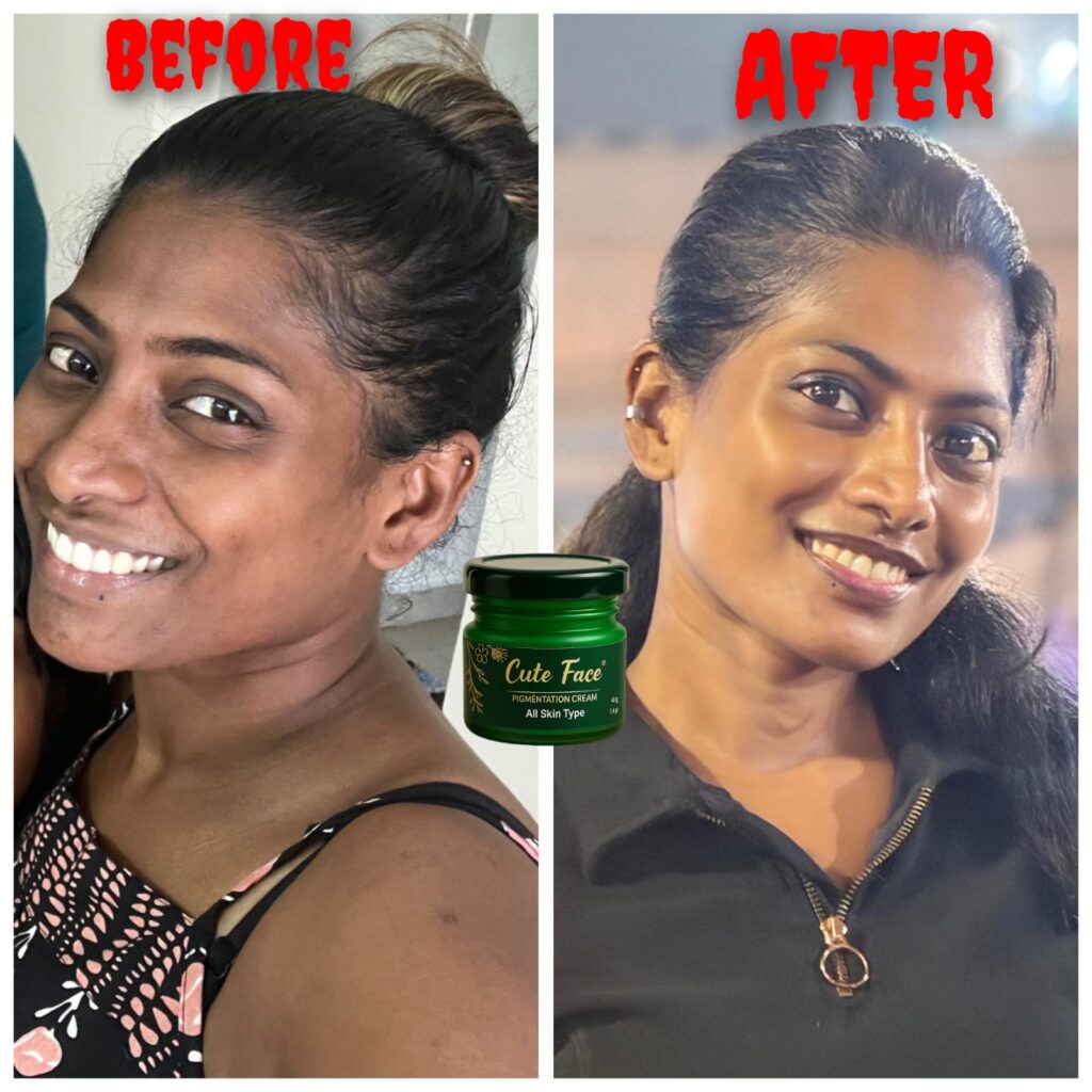 Skincare Results