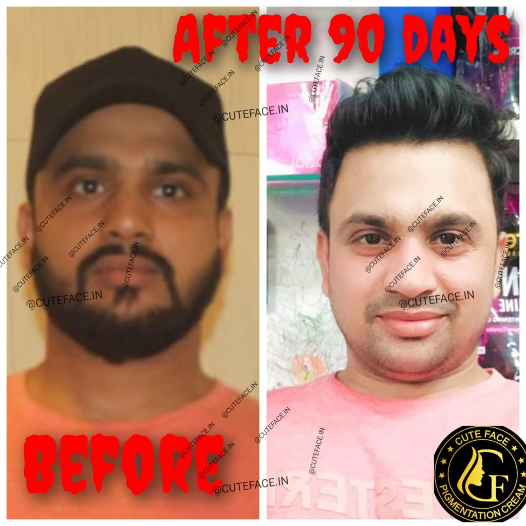Skincare Results