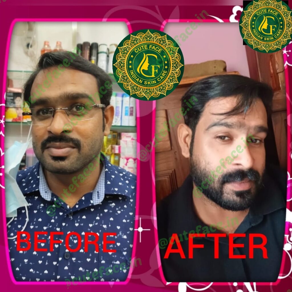 Skincare Results