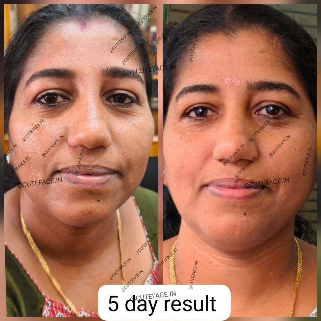 Skincare Results